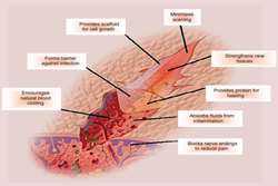 نشست خبری با موضوع: نانوالیاف الکتروریسی؛ کاهش گونه‌های فعال اکسیژن و تسریع بهبود زخم